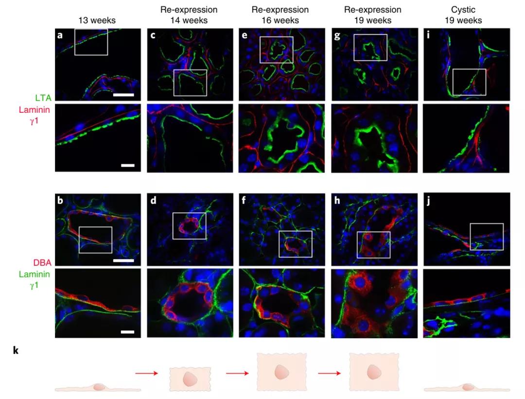 無需腎移植！Nature子刊：科學家通過逆轉小鼠多囊腎病揭示腎臟的可塑性