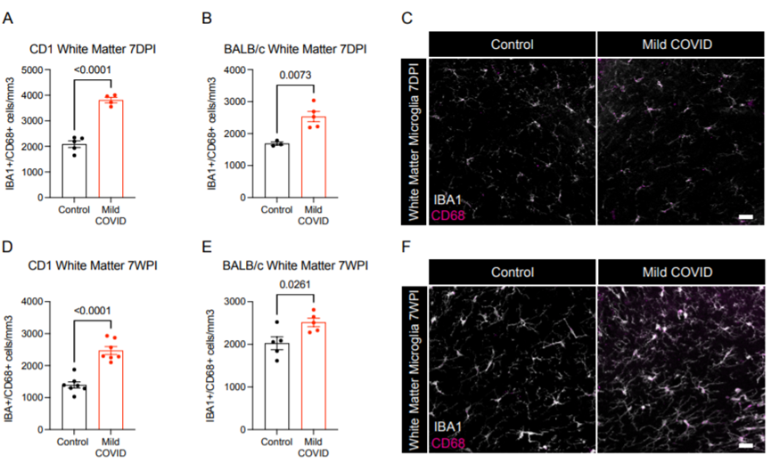 新冠竟能“傷腦”？耶魯科學家找到SARS-CoV-2損害神經系統新證據