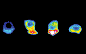 Developmental Cell：為入侵細胞的“前線”提供燃料