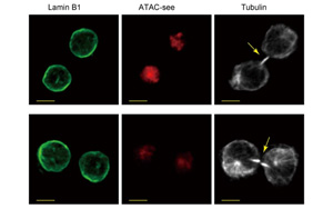 是什么決定了CD8+ T細(xì)胞的命運(yùn)?Immunity新研究指向cBAF復(fù)合物 是什么決定了CD8+ T細(xì)胞的命運(yùn)?Immunity新研究指向cBAF復(fù)合物
