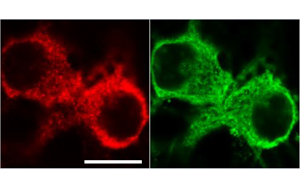 《PNAS》從過(guò)度反應(yīng)蛋白合成到認(rèn)知障礙，敲除1個(gè)基因即可