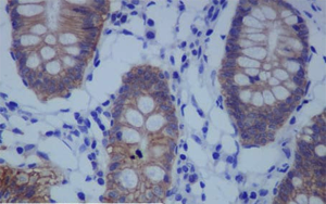 《PNAS》一種不為人知的蛋白質(zhì)，它能保持人體細(xì)胞的健康