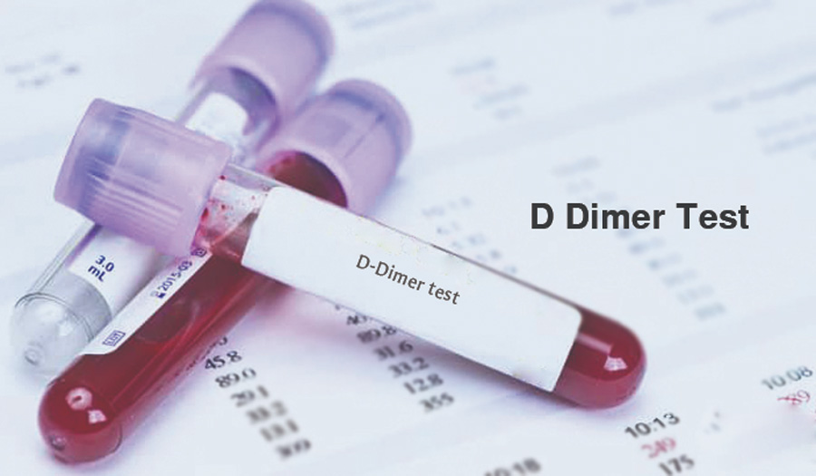 D-二聚體(D-Dimer)-磁微粒化學法學發光(AP/AE) /熒光免疫層析解決方案 D-二聚體(D-Dimer)-磁微粒化學法學發光(AP/AE) /熒光免疫層析解決方案